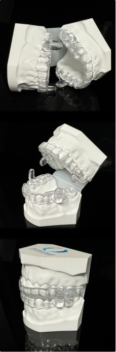 Oral appliance therapy
